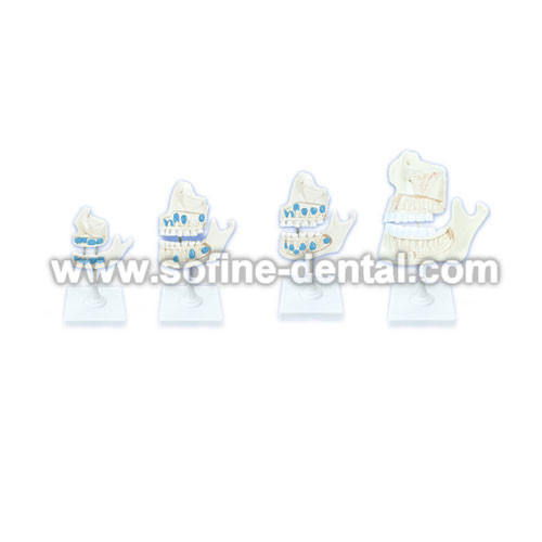 Dentition Teeth Model